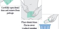 dental dam instruction picture