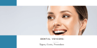 Dental Veneers