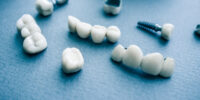 Affordable Dental Implants - How To Find Low Cost Options