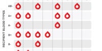 Blood Types And Compatibility: Crucial Factors In Transplants