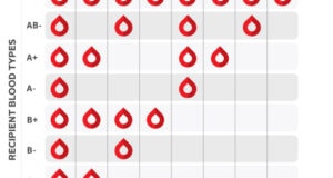 Blood Types And Compatibility: Crucial Factors In Transplants