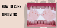 How To Cure Gingivitis