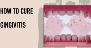 How To Cure Gingivitis