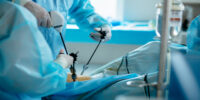 Minimally Invasive Surgery Tourism: Advancements And Benefits