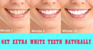 Natural Teeth Whitening - Tricks For A Whiter Smile