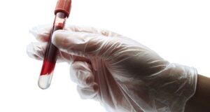 The Benefits Of Regular Blood Tests: Monitoring Your Health