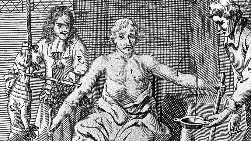 The Fascinating World Of Blood Transfusion: History And Modern Practices