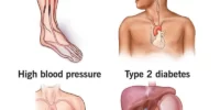 The Impact Of High Cholesterol On Blood Health