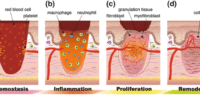 The Role Of Blood Clotting In Wound Healing