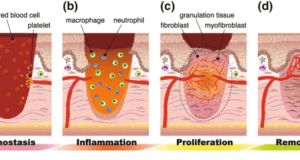 The Role Of Blood Clotting In Wound Healing