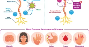 Top Allergies And Autoimmune Disorders