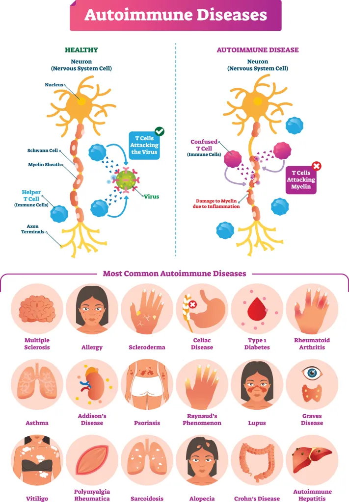 Top Allergies And Autoimmune Disorders