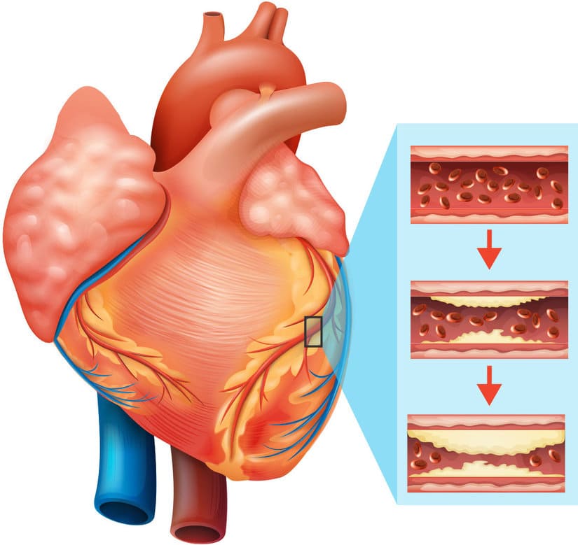 What Is The Cardiovascular System? Hypertension And Heart Disease