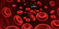 Anemia