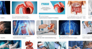 Gastrointestinal Surgery