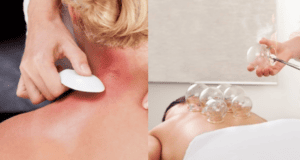 Cupping Therapy Vs. Gua Sha