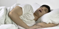 Sleep Apnea