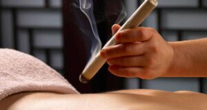 Moxibustion Therapy