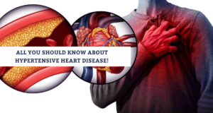 Hypertensive Heart Disease