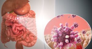 Gastroenteritis Vs. Rotavirus