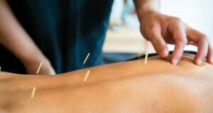Acupuncture Provide Effective Pain Management
