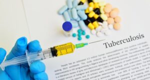 Tuberculosis Treatment