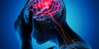 Hypertension On The Brain