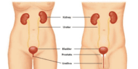 Woman Urinary Tract Infection