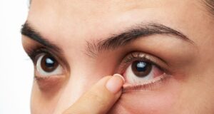 Connection Between Diabetes and Eye Diseases